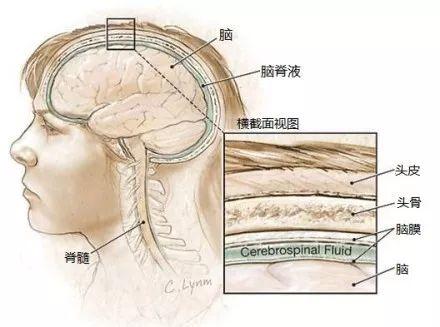 女子没感冒一直流鼻涕竟是脑脊液